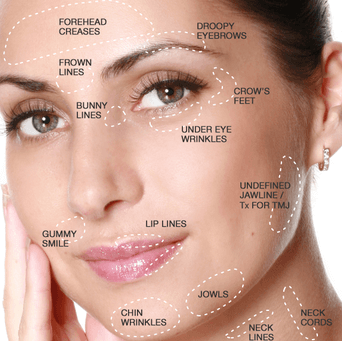 botox edinburgh