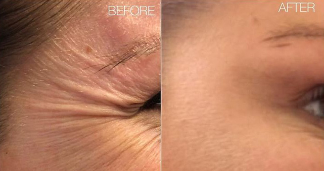 botox marchmont dental edinburgh
